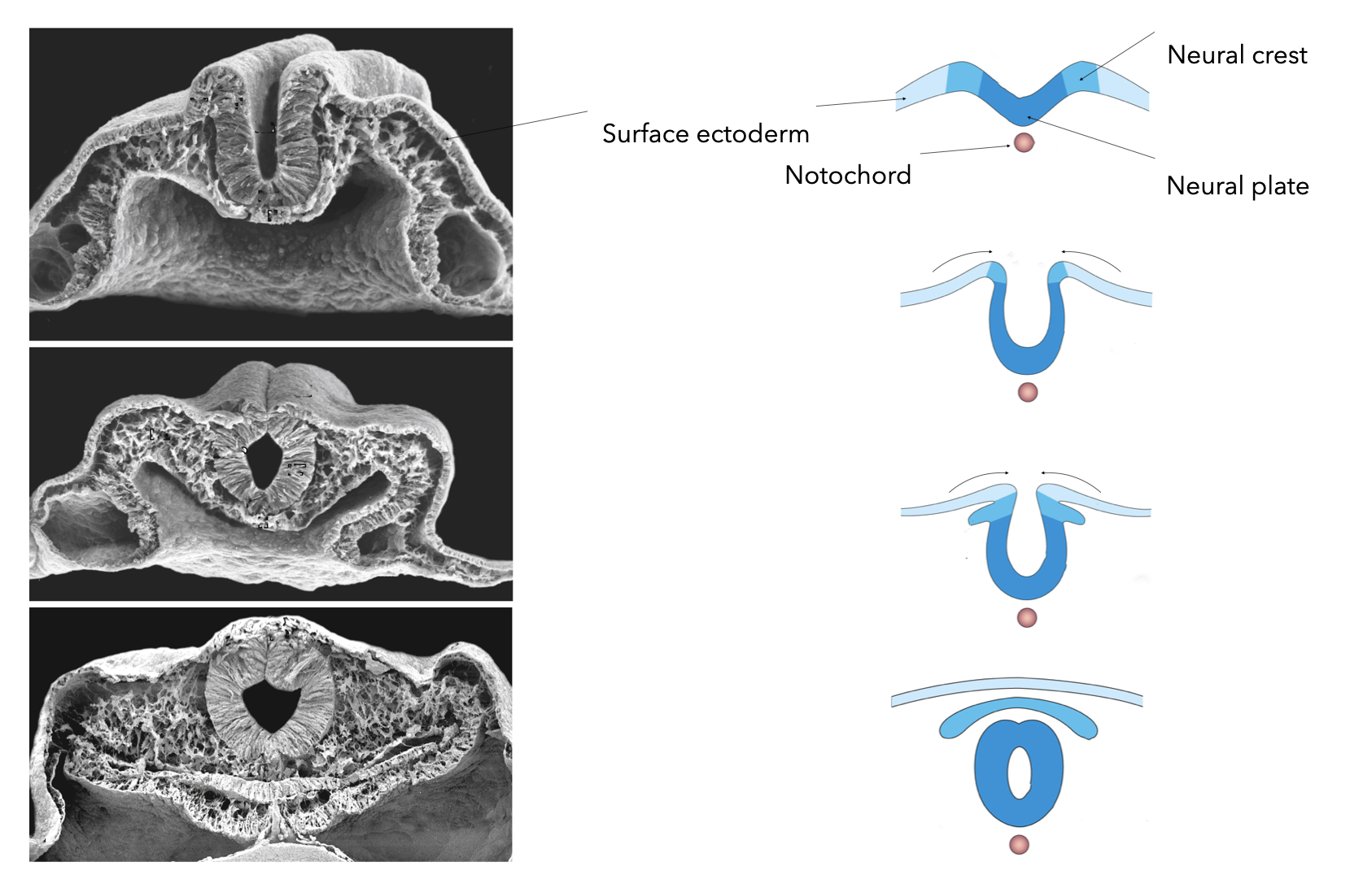 Apical constriction and crawling of surface ectoderm cells push edges of neural plate together.