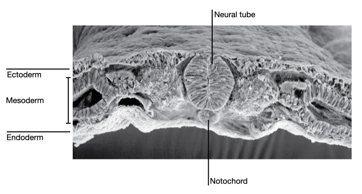 The notochord develops ventrally to the neural tube in the mesoderm.
