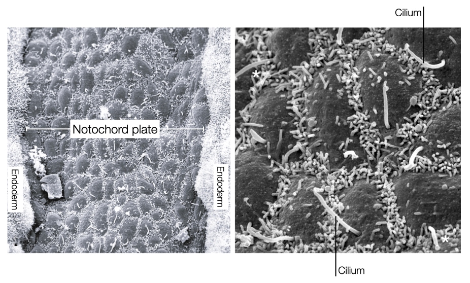 Cells in the notochord plate contain cilia.