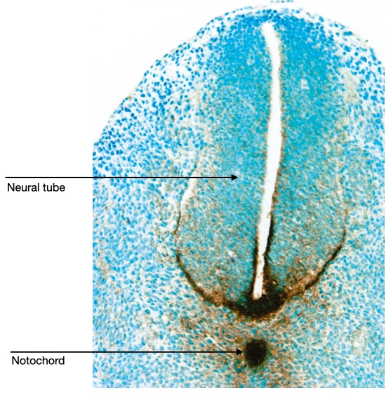 Signaling molecules from notochord determine dorsal-ventral axis of spinal cord.