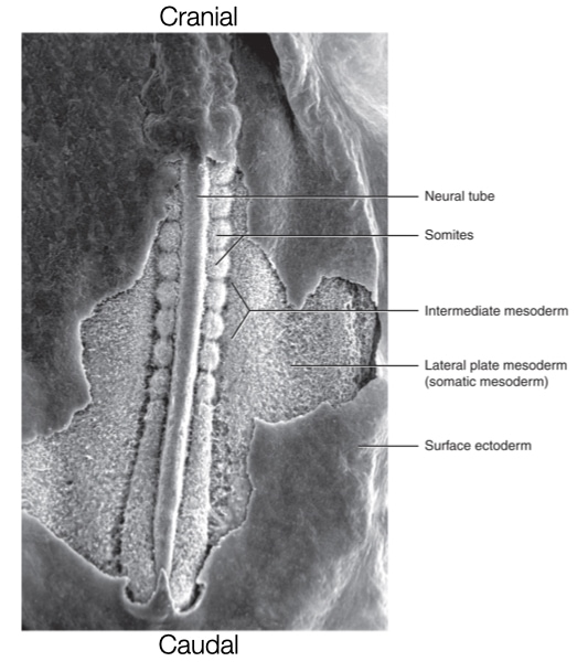 Somites are a mesoderm-derived structure that generates segmentation along the cranial-caudal axis.